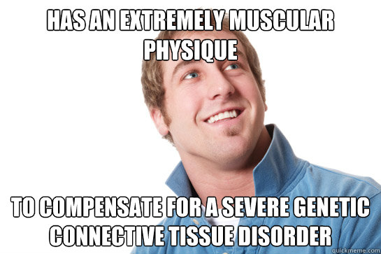 Has An Extremely Muscular physique to compensate for a severe genetic connective tissue disorder  Misunderstood D-Bag