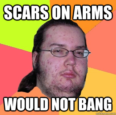 Scars on arms would not bang - Scars on arms would not bang  Butthurt Dweller