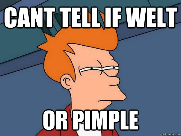 Cant tell if welt Or pimple   Futurama Fry