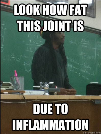 LOOK HOW FAT THIS JOINT IS due to inflammation   Rasta Science Teacher