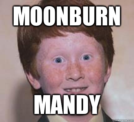 Moonburn Mandy  Over Confident Ginger