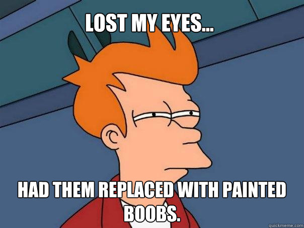 Lost my eyes... Had them replaced with painted boobs.  Futurama Fry