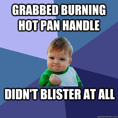 Grabbed Burning hot pan handle Didn't blister at all  Success Kid