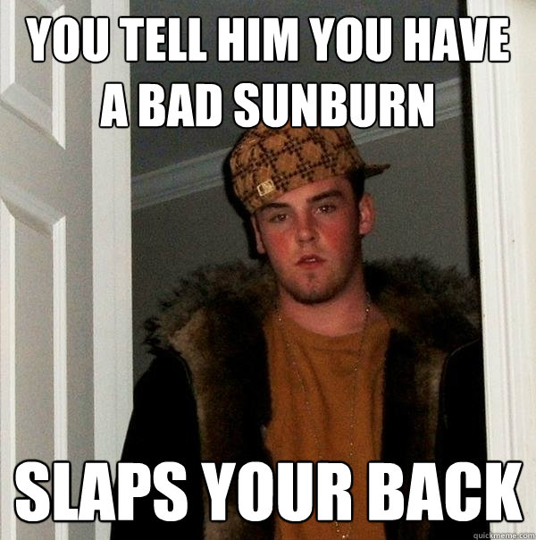 you tell him you have a bad sunburn slaps your back  Scumbag Steve