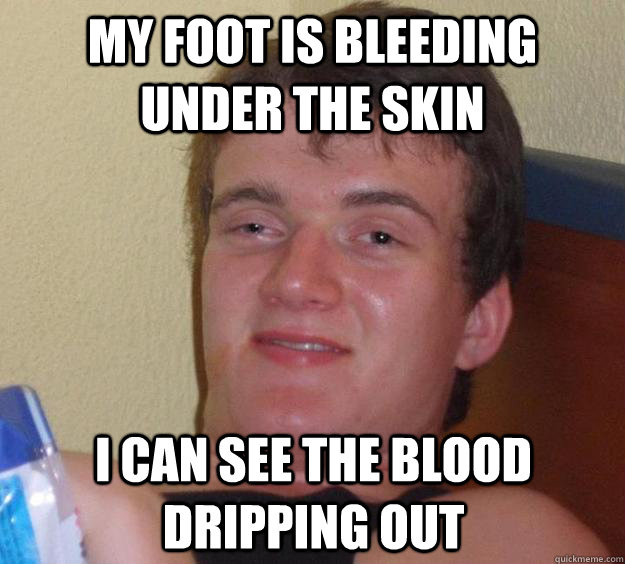 My foot is bleeding under the skin I can see the blood dripping out  10 Guy