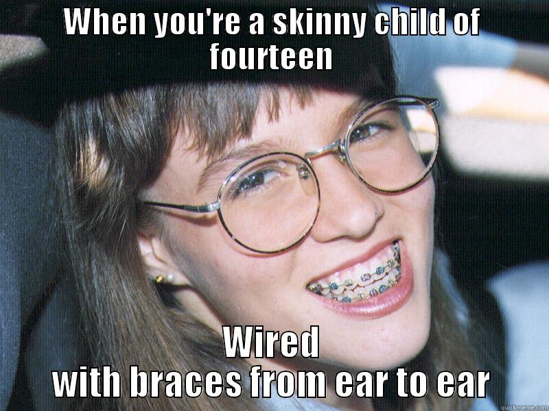 WHEN YOU'RE A SKINNY CHILD OF FOURTEEN WIRED WITH BRACES FROM EAR TO EAR Misc