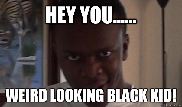 Hey You...... Weird looking black kid!  