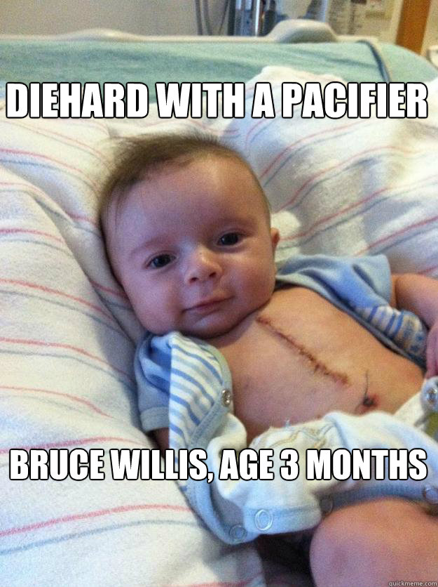 DIEHARD WITH A PACIFIER BRUCE WILLIS, AGE 3 MONTHS  Ridiculously Goodlooking Surgery Baby