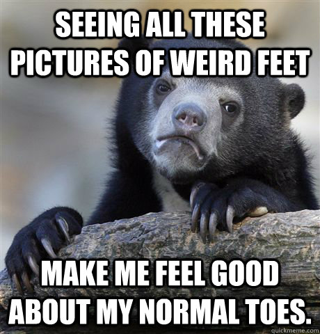 Seeing all these pictures of weird feet Make me feel good about my normal toes.  Confession Bear