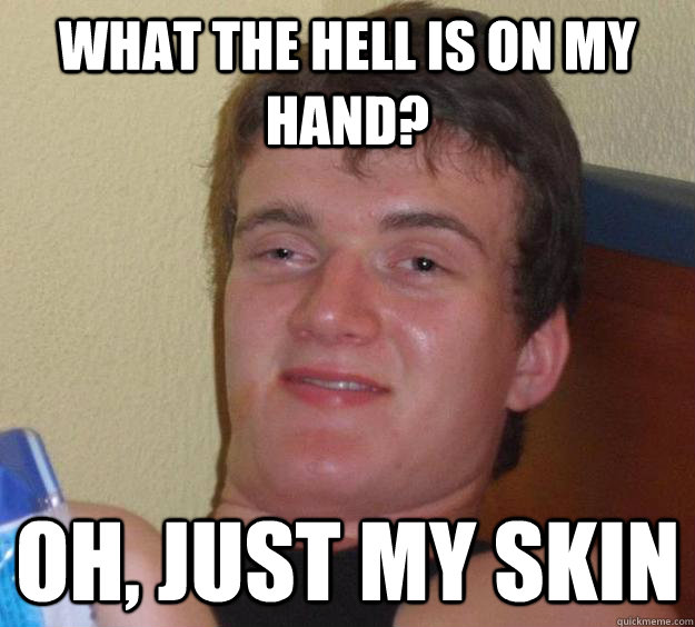 What the hell is on my hand? oh, just my skin  10 Guy