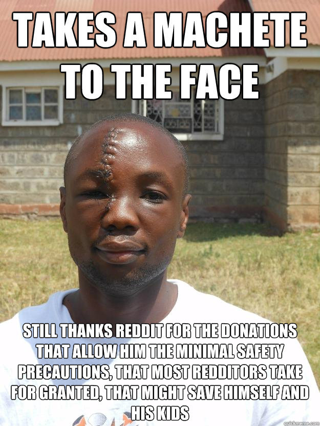 Takes a machete to the face Still thanks Reddit for the donations that allow him the minimal safety precautions, that most redditors take for granted, that might save himself and his kids - Takes a machete to the face Still thanks Reddit for the donations that allow him the minimal safety precautions, that most redditors take for granted, that might save himself and his kids  GOOD GUY OMARI