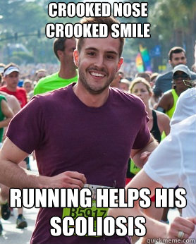 crooked nose 
Crooked smile Running helps his scoliosis  Ridiculously photogenic guy