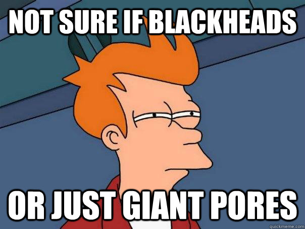 Not sure if blackheads or just giant pores  Futurama Fry